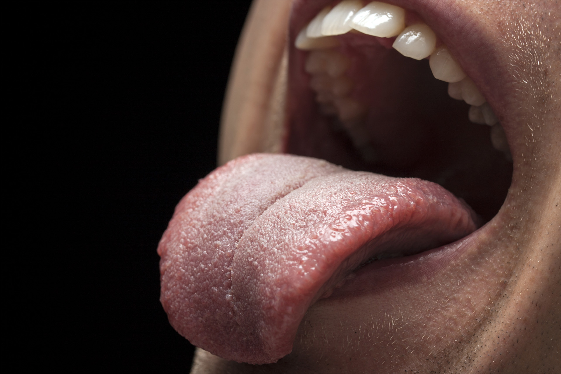 Mundhygiene-Tipp 3: Zungenbelag & Zungenreinigung