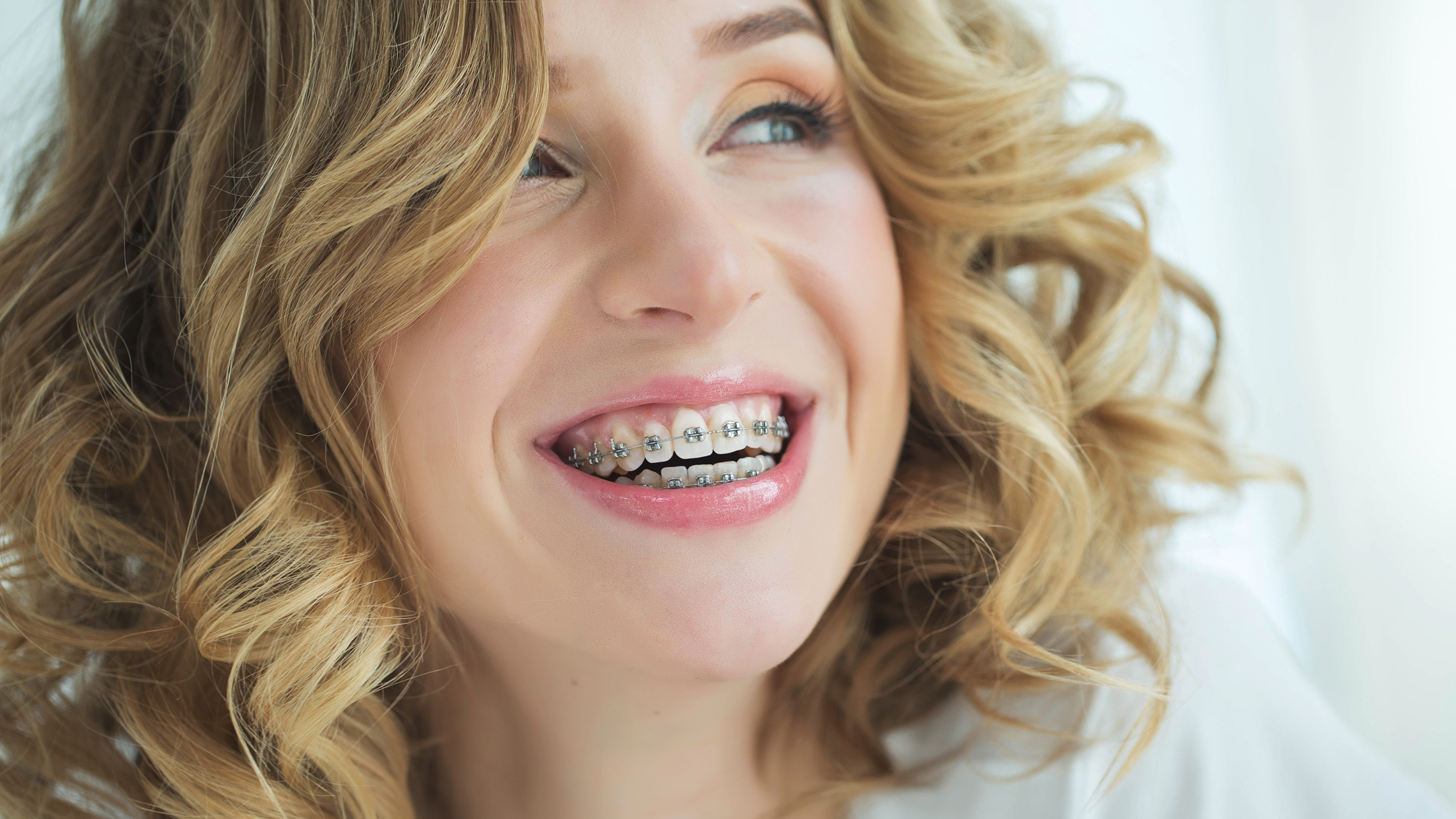Zahnfehlstellungen bei Erwachsenen – wann lohnt sich eine Zahnspange?
