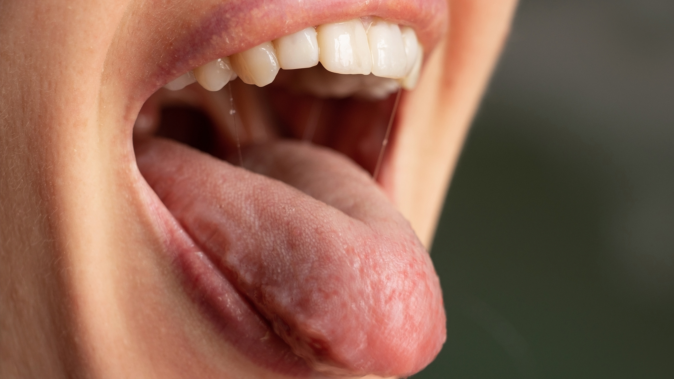 Speichel: Wichtiger Bestandteil der Zahngesundheit