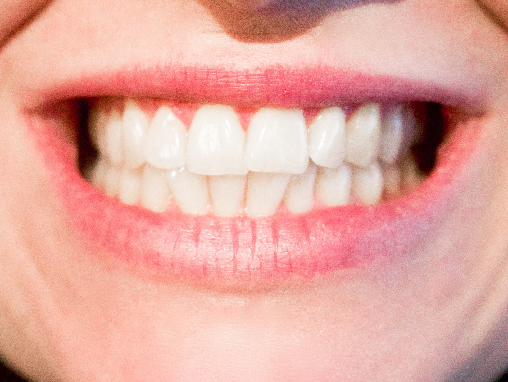 Irrtum fünf: Zahnfleisch, das nicht blutet, ist gesund