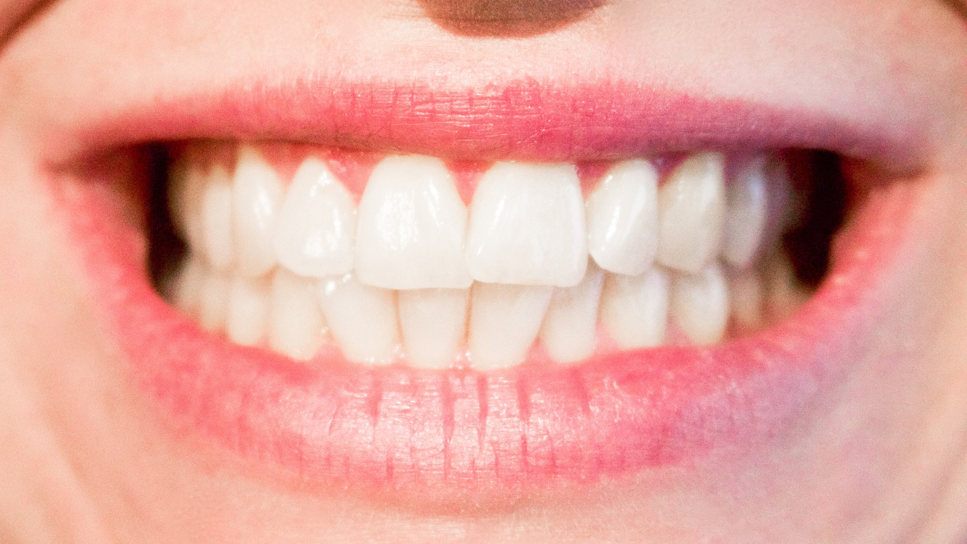 9 Tipps für gesunde und schöne Zähne